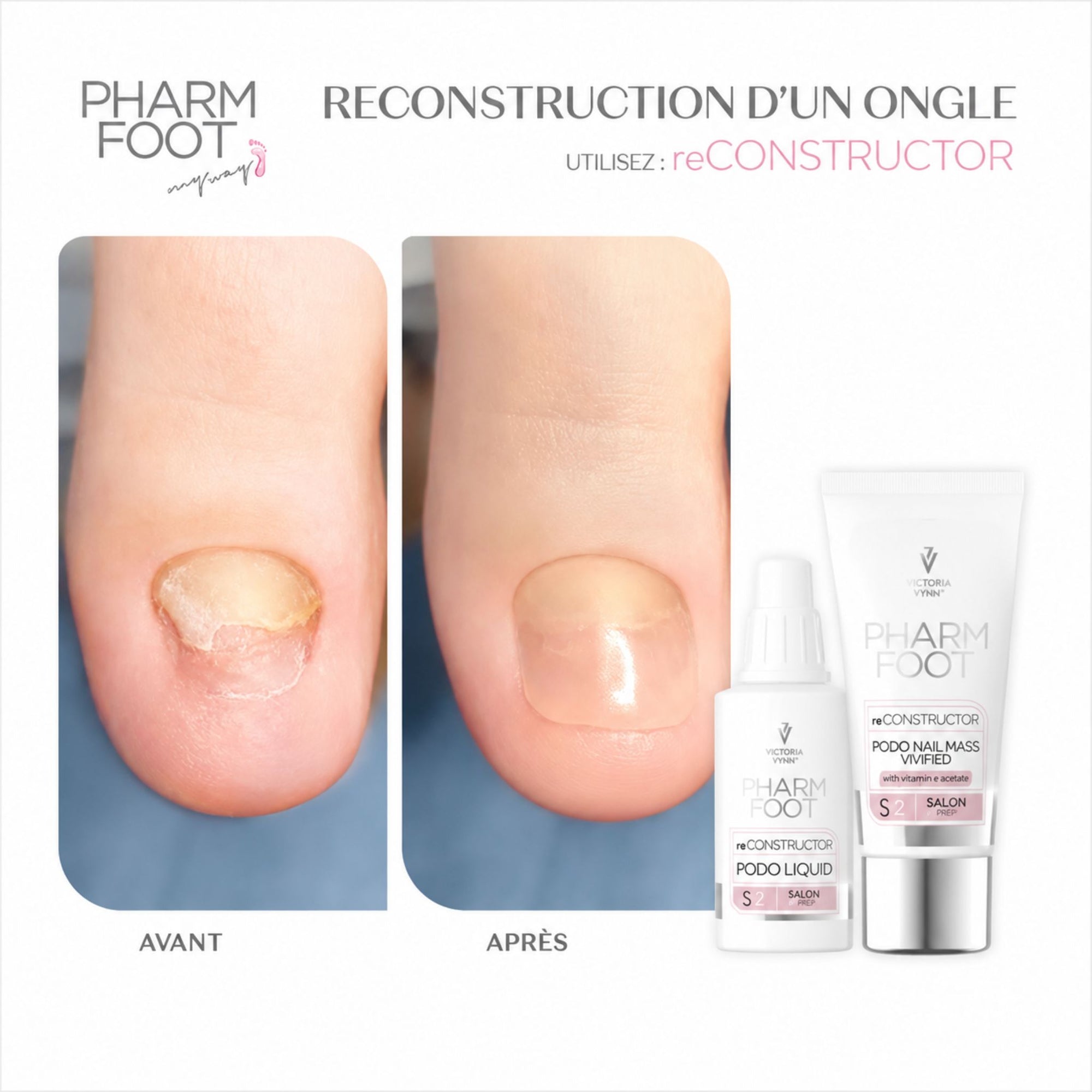 Kit reconstruction ongles orteils UV/LED Pharm Foot reCONSTRUCTOR – Mon Style Mes Ongles Québec